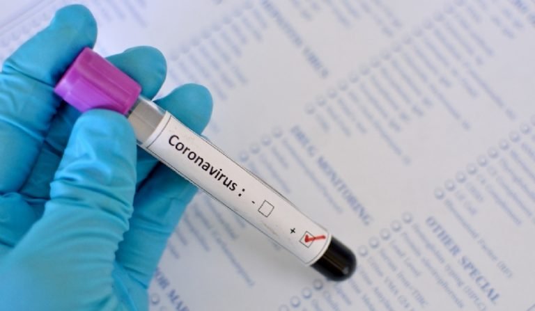 Sobe para 62 o número de casos confirmados do coronavírus no Maranhão